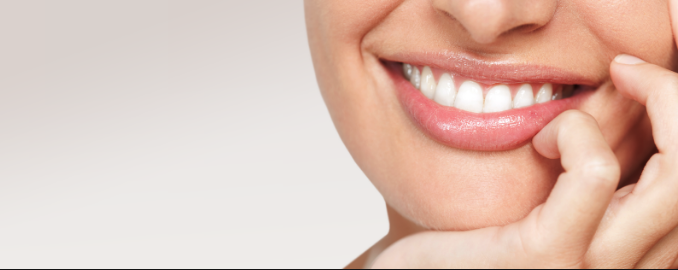 in chair teeth whitening