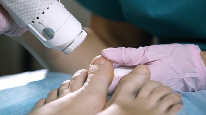 Podiatrist in Castle Hill