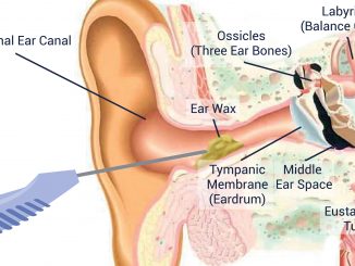 blocked ear wax removal