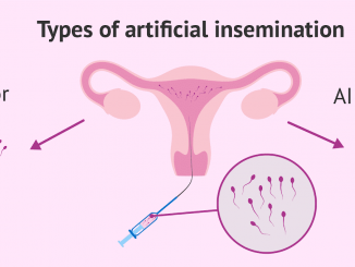 Artificial Insemination Cost