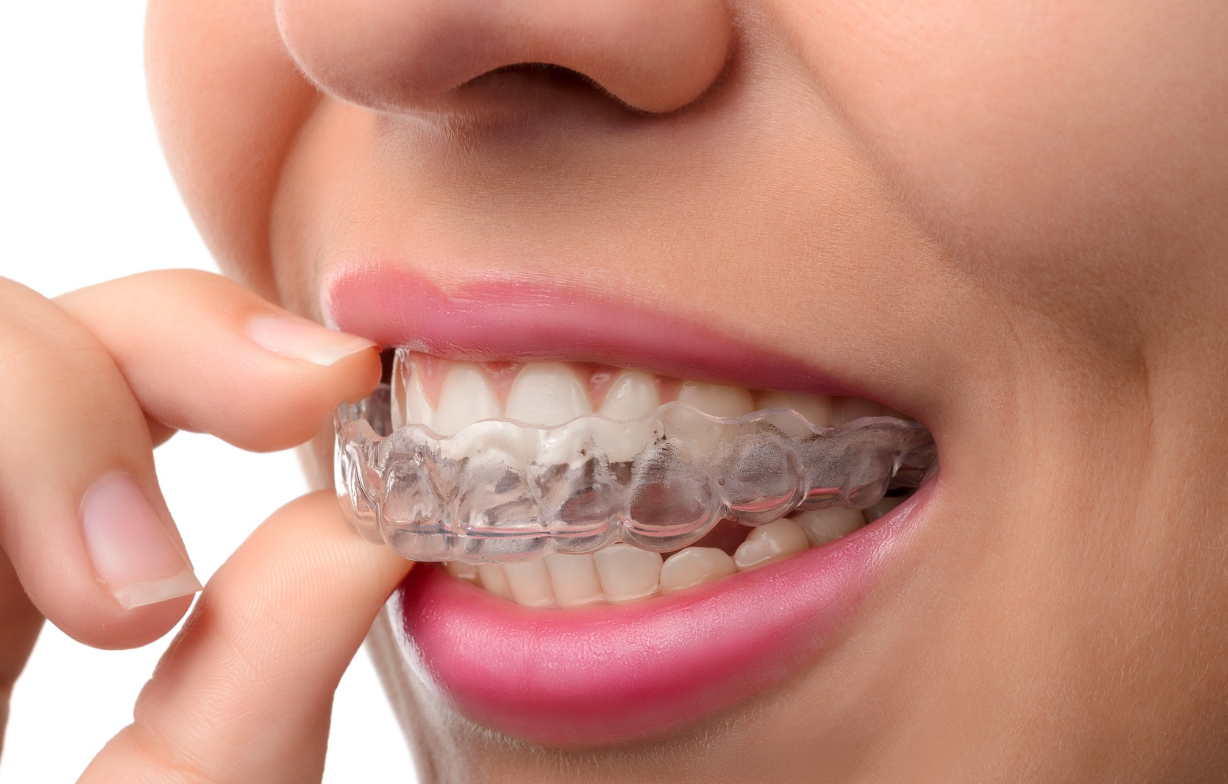orthodontic treatment