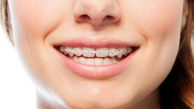 orthodontic treatment