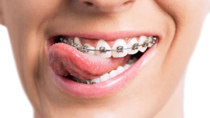 orthodontist in Greensboro NC