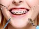 orthodontic treatment