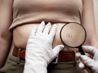 umbilical hernia surgeon